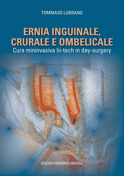 Ernia inguinale, crurale e ombelicale. Cura mininvasiva hi-tech in day surgery - Tommaso Lubrano - copertina