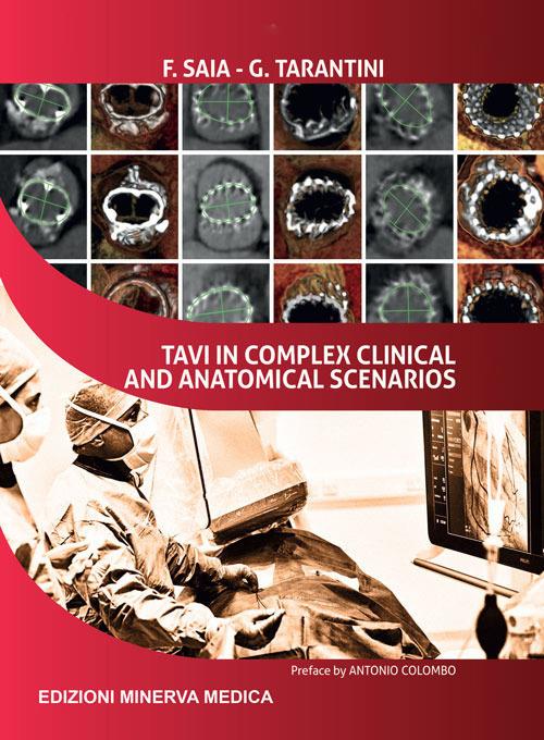 TAVI in complex clinical and anatomical scenarios - Francesco Saia,Giuseppe Tarantini - copertina