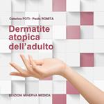 Dermatite atopica dell'adulto