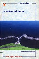 La frattura del sorriso