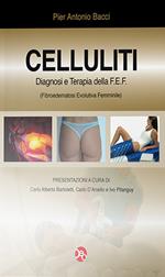 Celluliti 2012. Diagnosi e terapia della FEF (fibroedematosi evolutiva femminile)