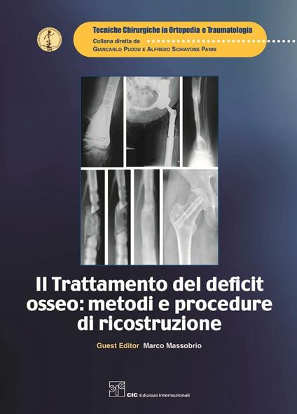 Il trattamento del deficit osseo: metodi e procedure di ricostruzione - copertina