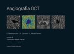 Angiografia oct