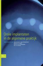 Orale implantaten in de algemene praktijk