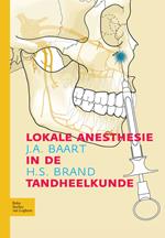 Lokale anesthesie in de tandheelkunde