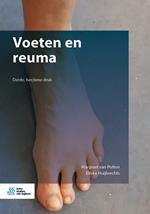 Voeten en reuma