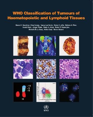 WHO classification of tumours of haematopoietic and lymphoid tissues: Vol. 2 - International Agency for Research on Cancer - cover