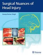 Surgical Nuances of Head Injury