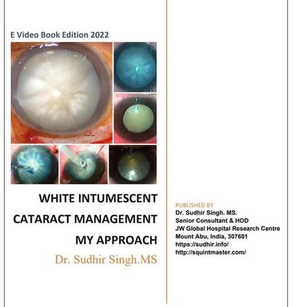 White Intumescent Cataract Management: My Approach