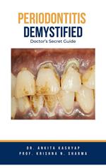 Periodontitis Demystified: Doctor's Secret Guide