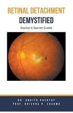 Retinal Detachment Demystified: Doctor's Secret Guide