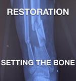 Restoration - Setting The Bone