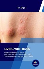 Living with Hives