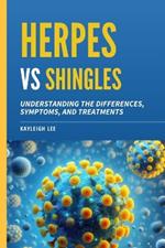 Herpes Versus Shingles: Understanding the Differences, Symptoms, and Treatments: Herpes Book