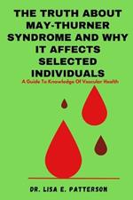 The Truth About May-Thurner Syndrome And Why It Affects Selected Individuals: A Guide To Knowledge Of Vascular Health