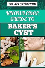 Knowledge Guide to Baker's Cyst: Essential Manual To Symptoms, Diagnosis, Treatment Options, And Prevention For Optimal Knee Health
