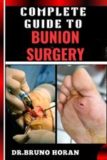 Complete Guide to Bunion Surgery: Essential Handbook For Expert Techniques, Recovery Tips, And Pain Management For Optimal Foot Health