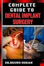 Complete Guide to Dental Implant Surgery: Comprehensive Manual To Advanced Techniques, Recovery, and Best Practices for Optimal Oral Health