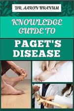 Knowledge Guide to Paget's Disease: Essential Manual To Symptoms, Diagnosis, Treatment Options, and Long-term Management