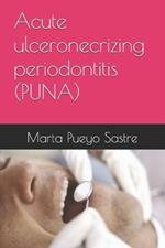 Acute ulceronecrizing periodontitis (PUNA)