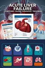 Acute Liver Failure - Symptoms, Causes, Diagnosis, Treatment: Acute liver failure is a medical emergency that can cause life-threatening complications. It's commonly caused by acetaminophen overdose.