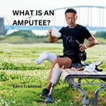 What Is An Amputee?