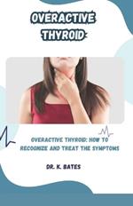 Overactive Thyroid: Overactive Thyroid: How to Recognize and Treat the Symptoms