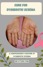 Cure for Dyshidrotic Eczema: A Comprehensive Overview of Dyshidrotic Eczema