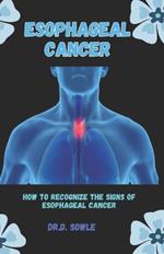 Esophageal Cancer: How to Recognize the Signs of Esophageal Cancer