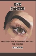 Eye Cancer: Eye Cancer: How to Recognize and Treat the Condition