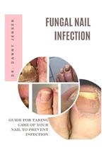 Fungal Nail Infection: Guide for Taking Care of Your Nail to Prevent Infection