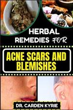Herbal Remedies for Acne Scars and Blemishes: Key Insights for a Flawless Complexion, focusing on Natural Healing, Lasting Skin Transformation and more