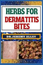 Herbs for Dermatitis Bites: Nature's Soothing Solutions: Unlocking The Power To Conquer Insect Disease Naturally