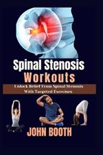 Spinal Stenosis Workouts: Unlock relief from spinal stenosis with targeted exercises