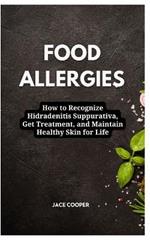 Food Allergies: How to Eat Well with Food Allergies: A Comprehensive Guide to Diagnosis, Treatment, and Beyond