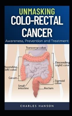 Unmasking Colo-Rectal Cancer: Awareness, Prevention and Treatment - Charles Hanson - cover