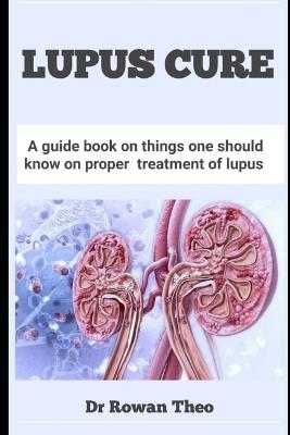 Lupus Cure: A guide book on things one should know on proper treatment of lupus - Rowan Theo - cover