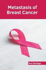 Metastasis of Breast Cancer