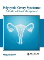 Polycystic Ovary Syndrome: A Guide to Clinical Management