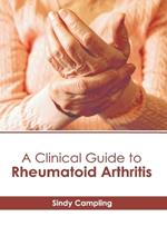 A Clinical Guide to Rheumatoid Arthritis