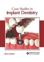 Case Studies in Implant Dentistry