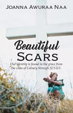 Beautiful Scars: Our Identity is Found in the Grace from the Cross of Calvary through Jesus